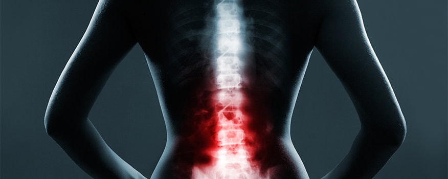 Navigating Treatment Options: Chiropractic Care for Disc Injuries