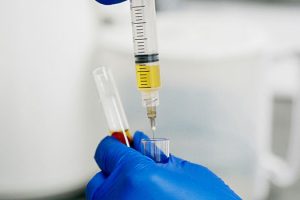 Targeting Chronic Joint Pain: How PRP Injections Work for Specific Conditions Like Arthritis