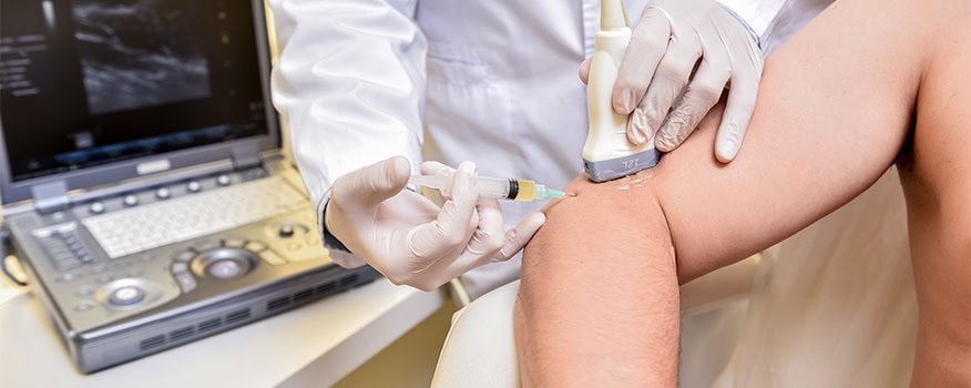 The Benefits of PRP Therapy for Joint Pain