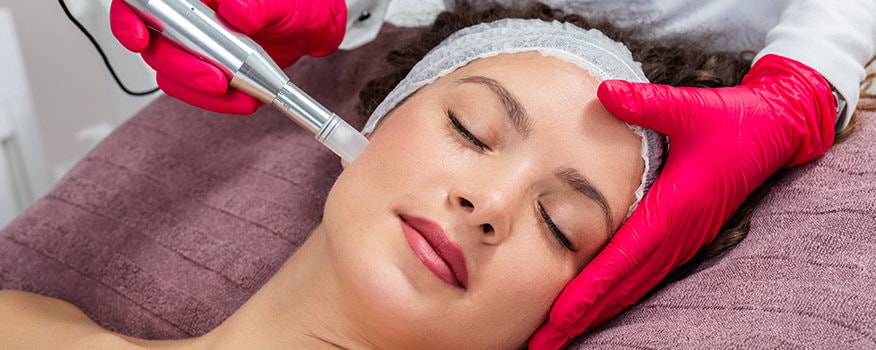 The Ultimate Guide to PRP Microneedling Facials: What You Need to Know