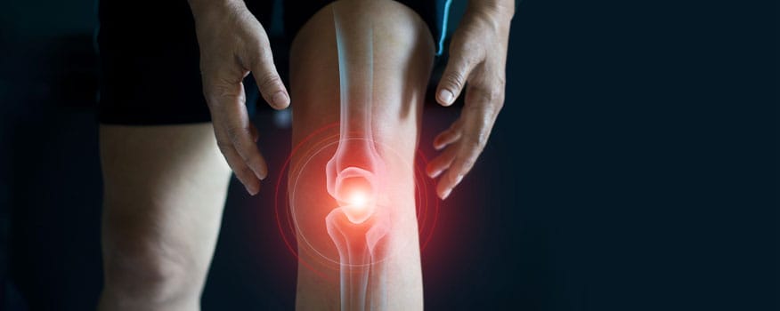 Treatments to Help Avoid Knee Replacement Surgery