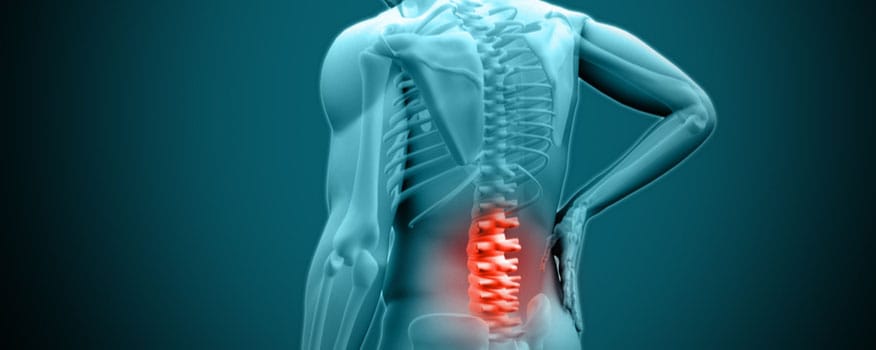 What is Scoliosis and How Can it be Treated?