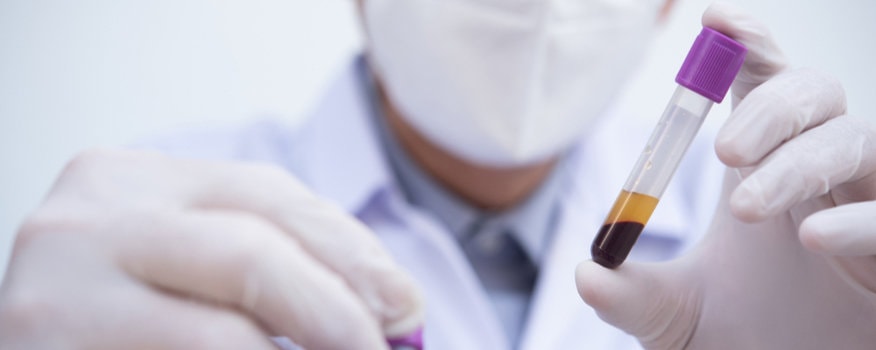What Types of Conditions Can be Treated with PRP?
