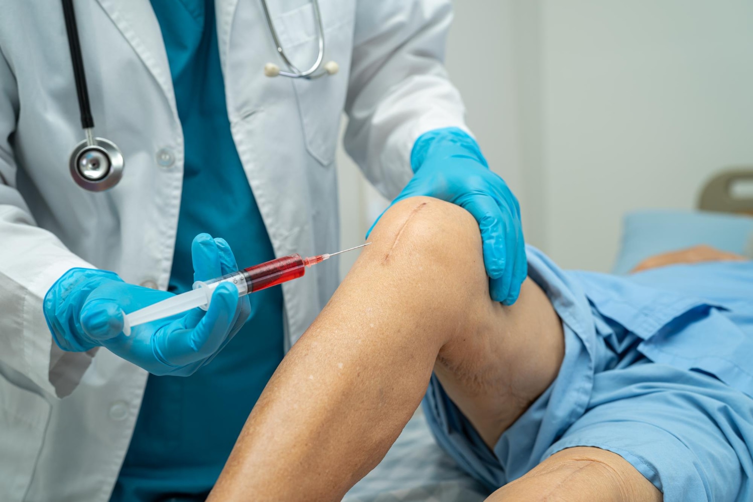 Stem Cell Therapy